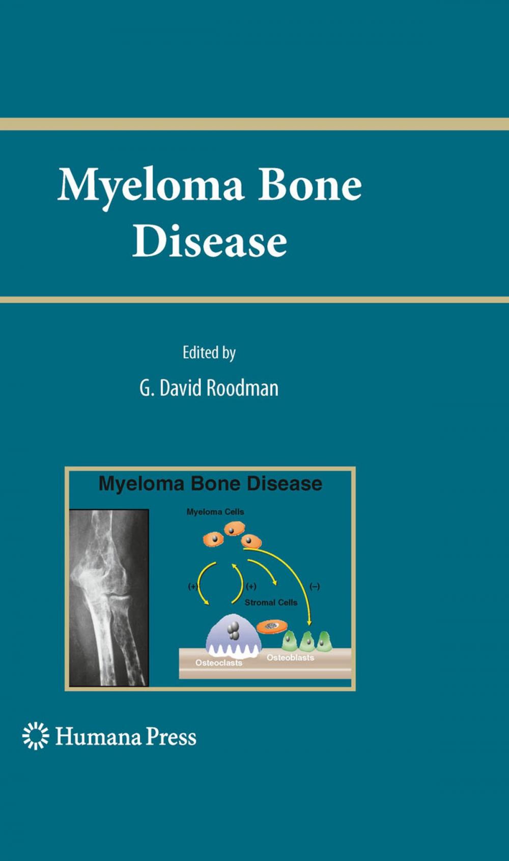 Big bigCover of Myeloma Bone Disease