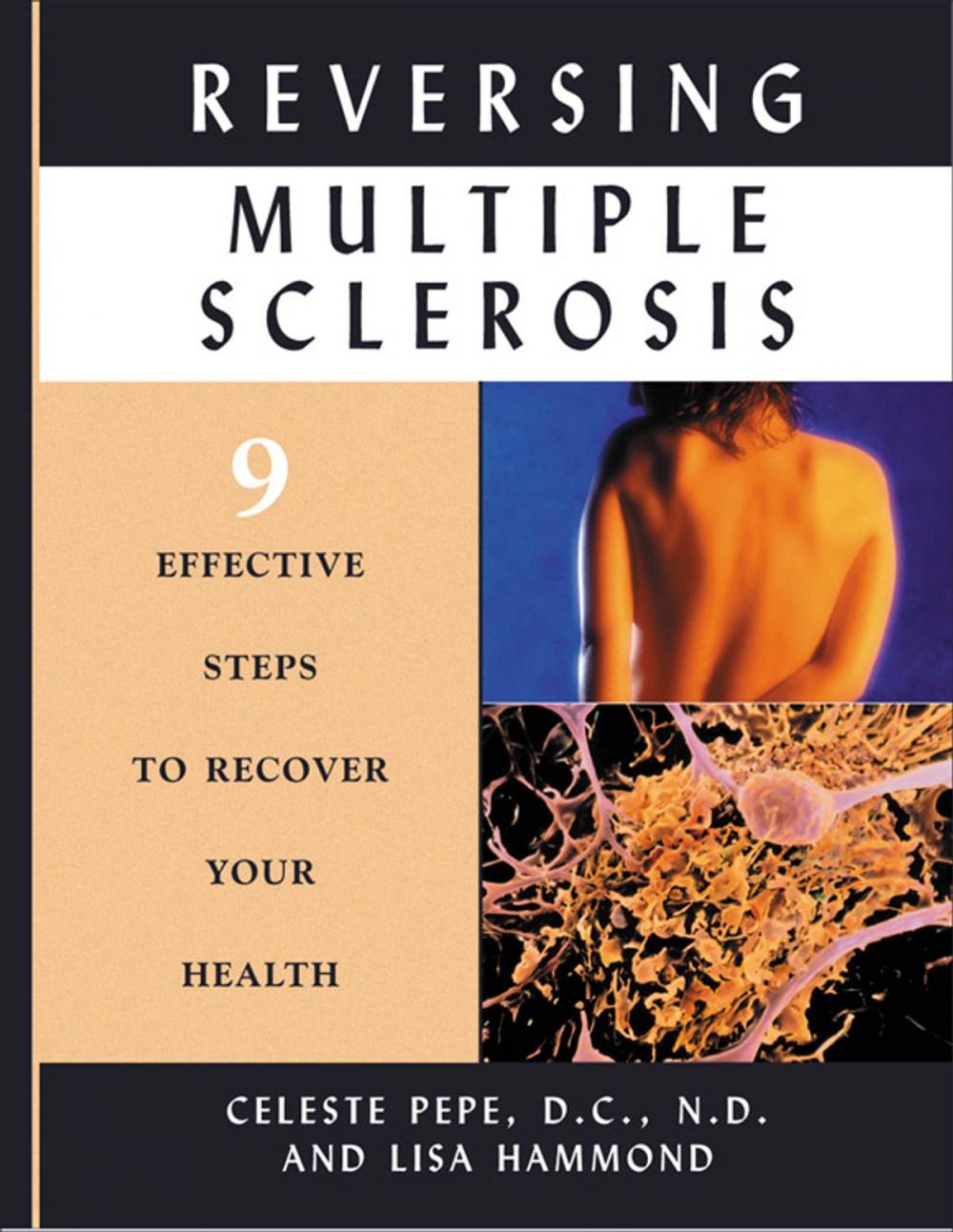 Big bigCover of Reversing Multiple Sclerosis: 9 Effective Steps to Recover Your Health