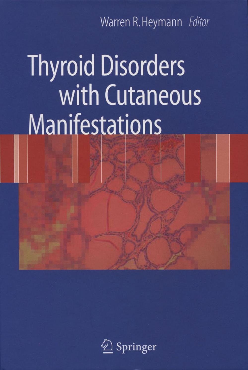 Big bigCover of Thyroid Disorders with Cutaneous Manifestations