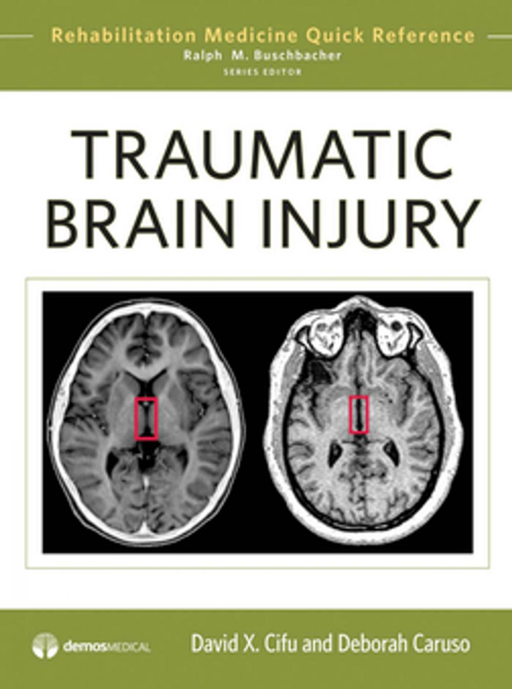 Big bigCover of Traumatic Brain Injury