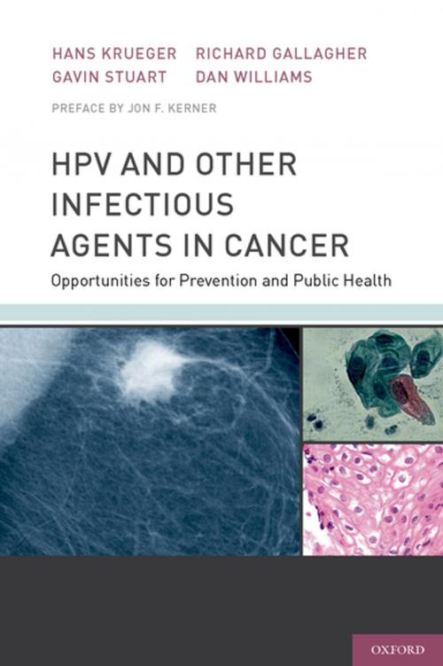 Cover of the book HPV and Other Infectious Agents in Cancer by Hans Krueger, Gavin Stuart, Richard Gallagher, Dan Williams, Jon Kerner, Oxford University Press