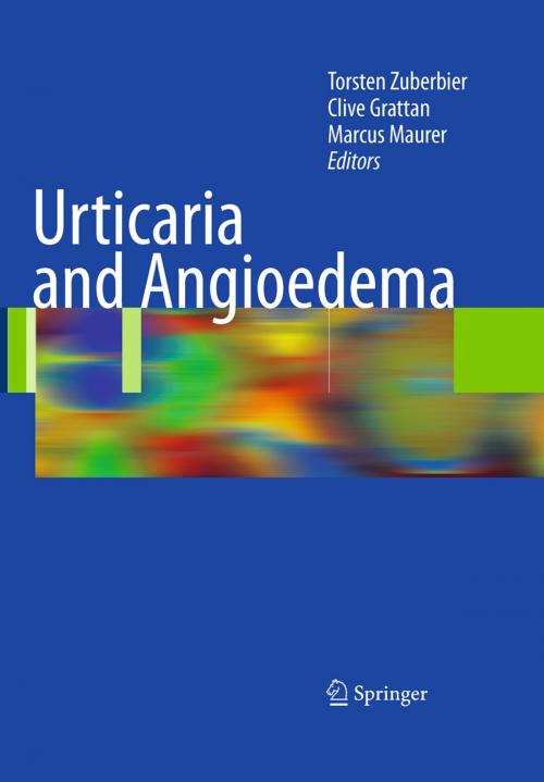 Cover of the book Urticaria and Angioedema by , Springer Berlin Heidelberg