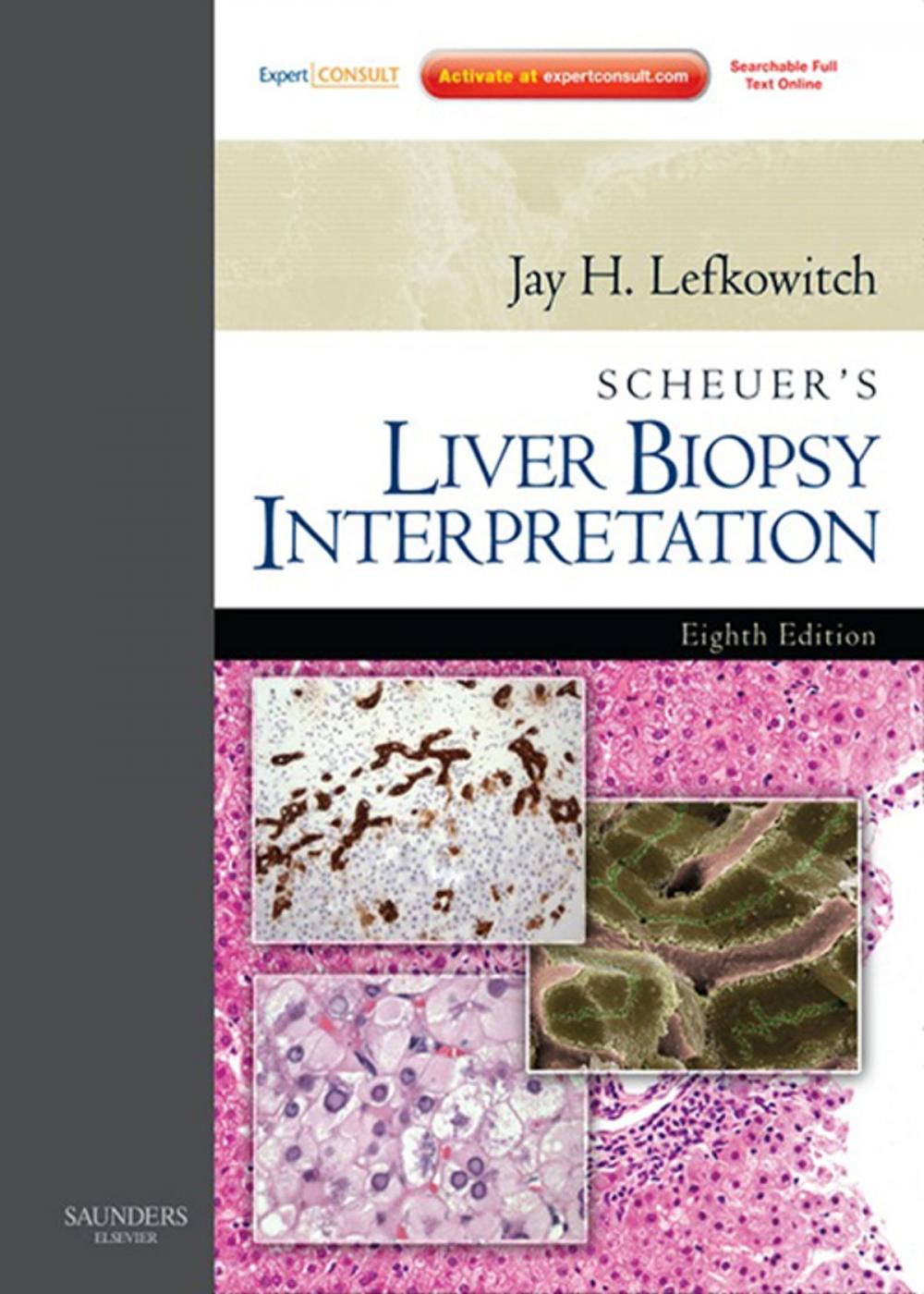 Big bigCover of Scheuer's Liver Biopsy Interpretation E-Book