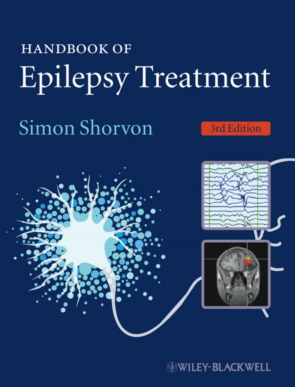 Big bigCover of Handbook of Epilepsy Treatment