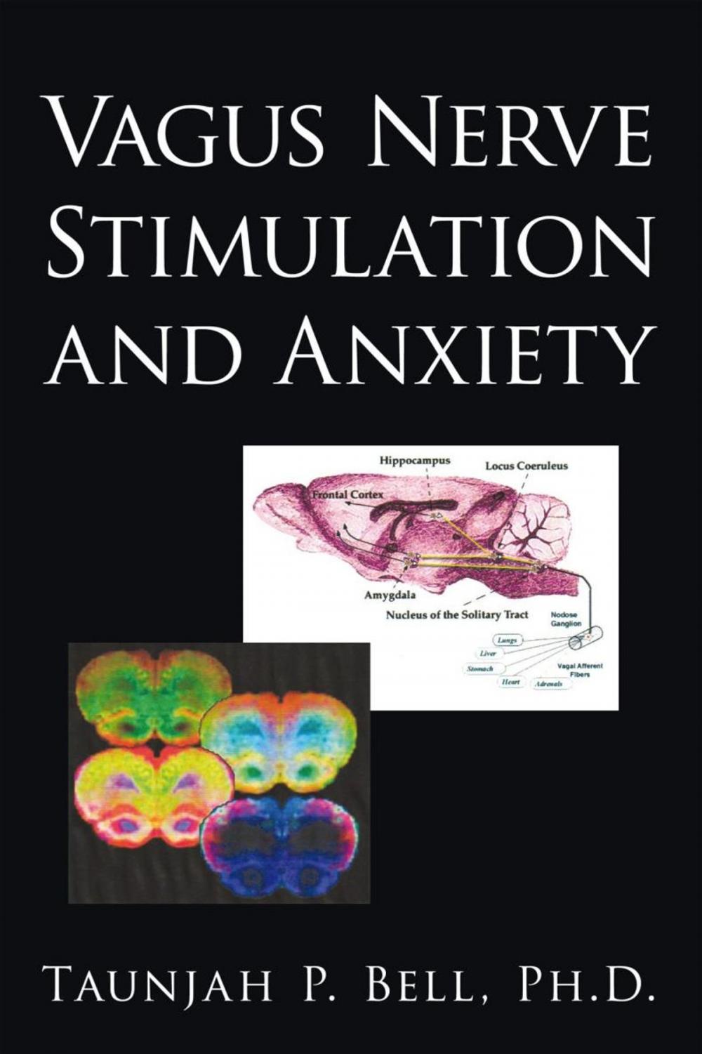 Big bigCover of Vagus Nerve Stimulation and Anxiety