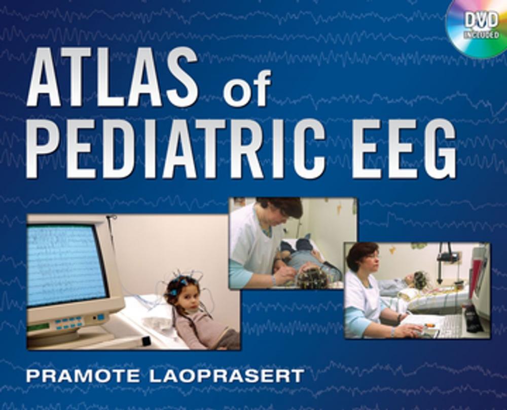 Big bigCover of Atlas of Pediatric EEG