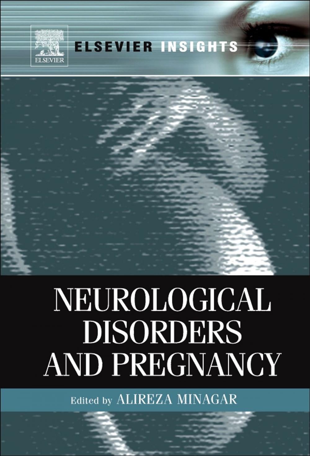 Big bigCover of Neurological Disorders and Pregnancy