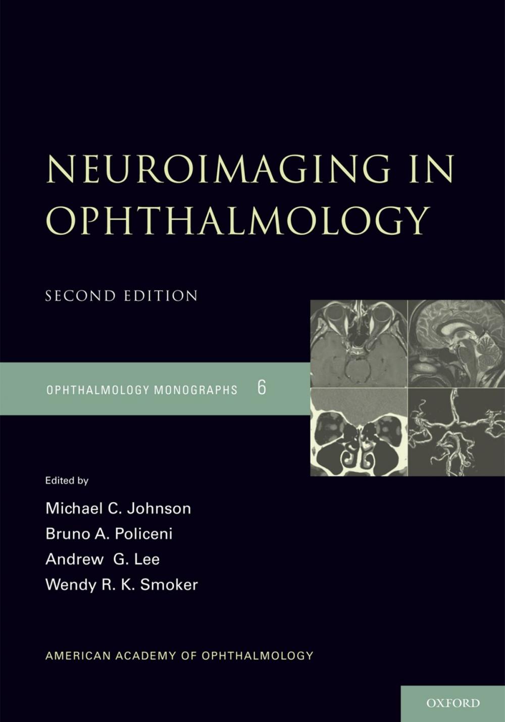 Big bigCover of Neuroimaging in Ophthalmology