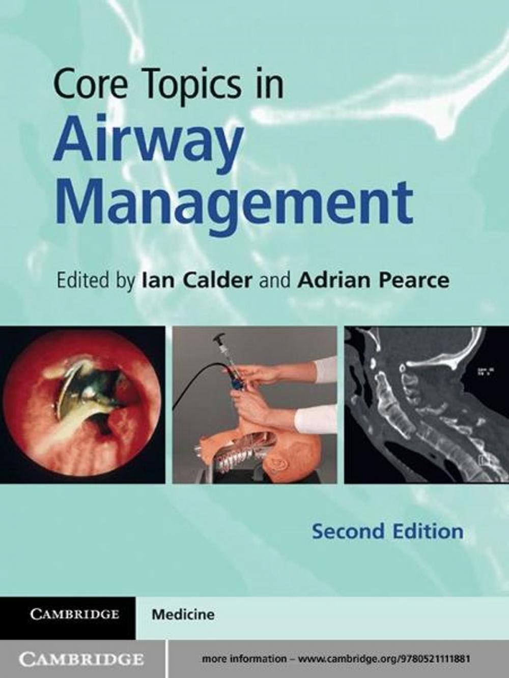 Big bigCover of Core Topics in Airway Management