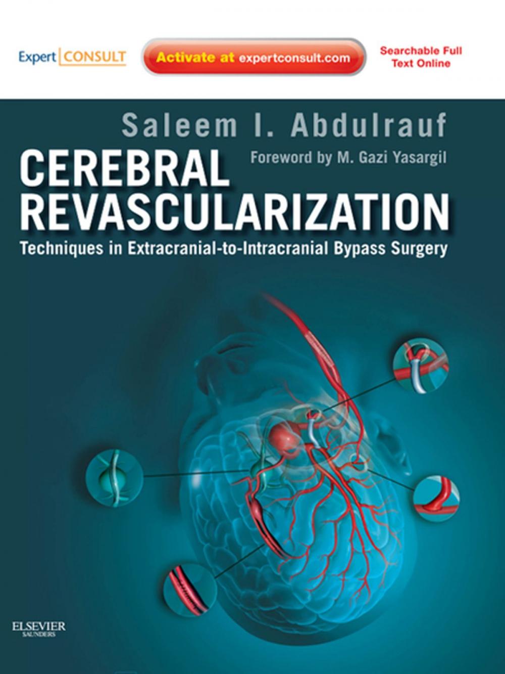 Big bigCover of Cerebral Revascularization - E-Book