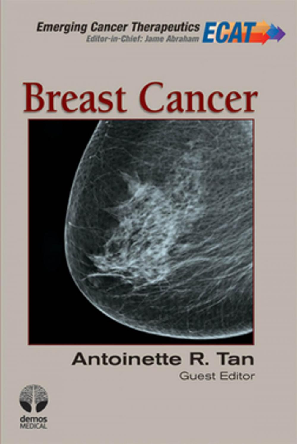 Big bigCover of Breast Cancer: ECT V1 I 3