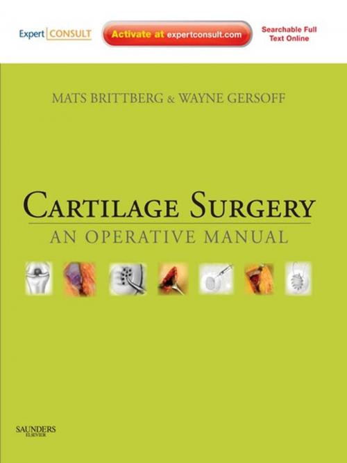 Cover of the book Cartilage Surgery E-Book by Mats Brittberg, MD, PhD, Wayne Gersoff, MD, Elsevier Health Sciences