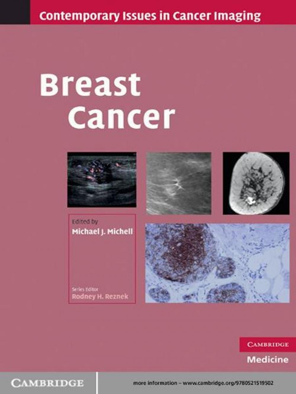 Big bigCover of Breast Cancer