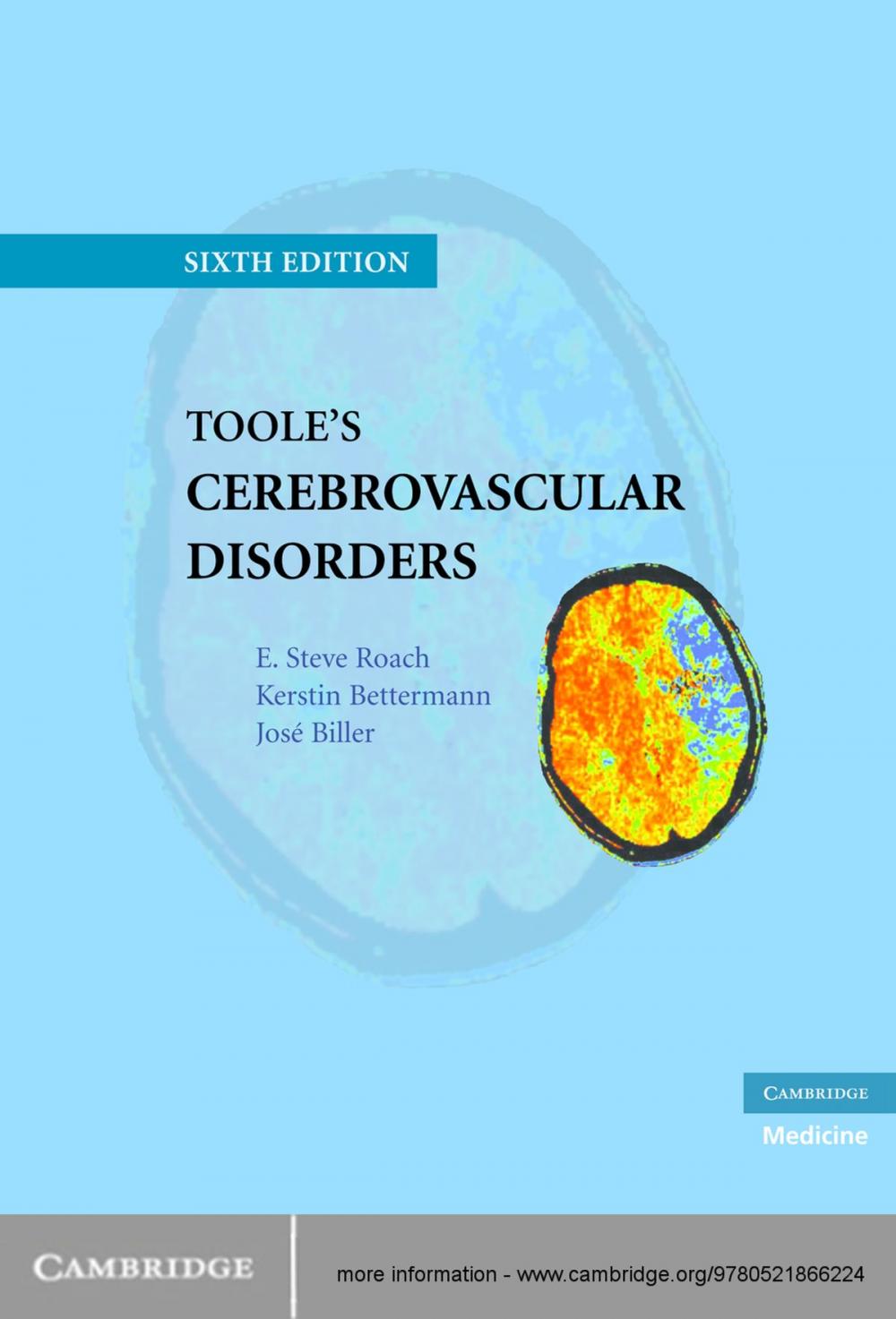 Big bigCover of Toole's Cerebrovascular Disorders