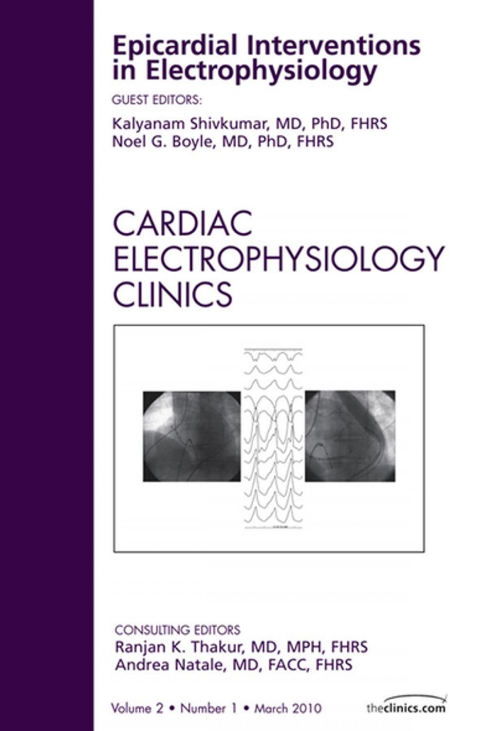 Big bigCover of Epicardial Interventions in Electrophysiology, An Issue of Cardiac Electrophysiology Clinics - E-Book