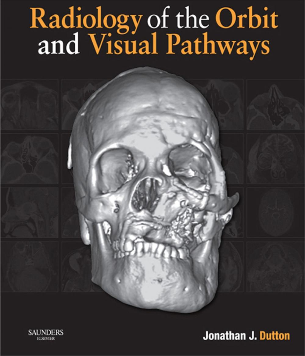 Big bigCover of Radiology of the Orbit and Visual Pathways E-Book