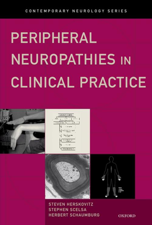 Cover of the book Peripheral Neuropathies in Clinical Practice by Steven Herskovitz, Stephen Scelsa, Herbert Schaumburg, Oxford University Press