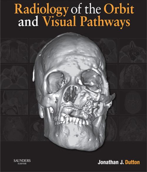 Cover of the book Radiology of the Orbit and Visual Pathways E-Book by Jonathan J Dutton, MD, PhD, Elsevier Health Sciences