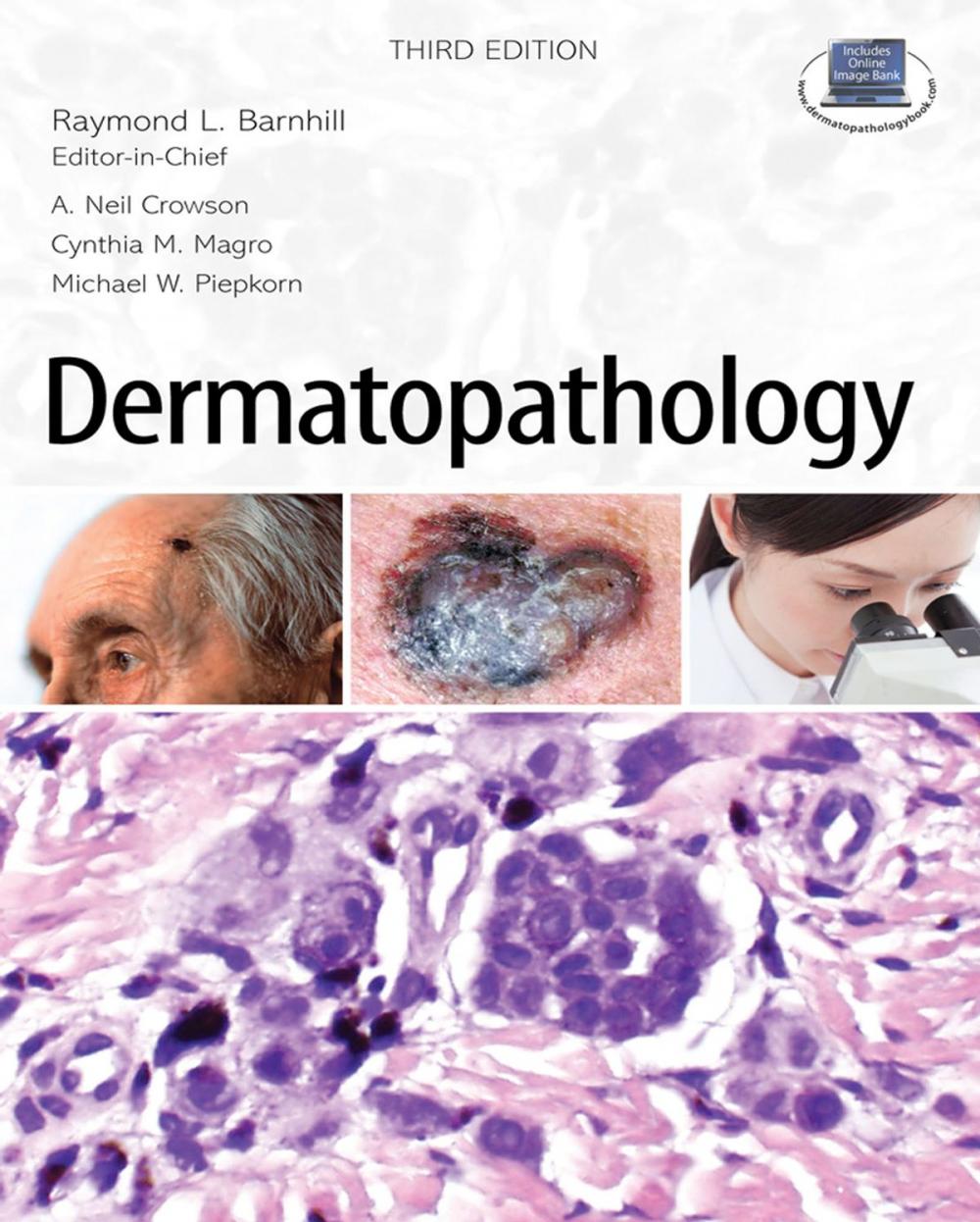 Big bigCover of Dermatopathology: Third Edition