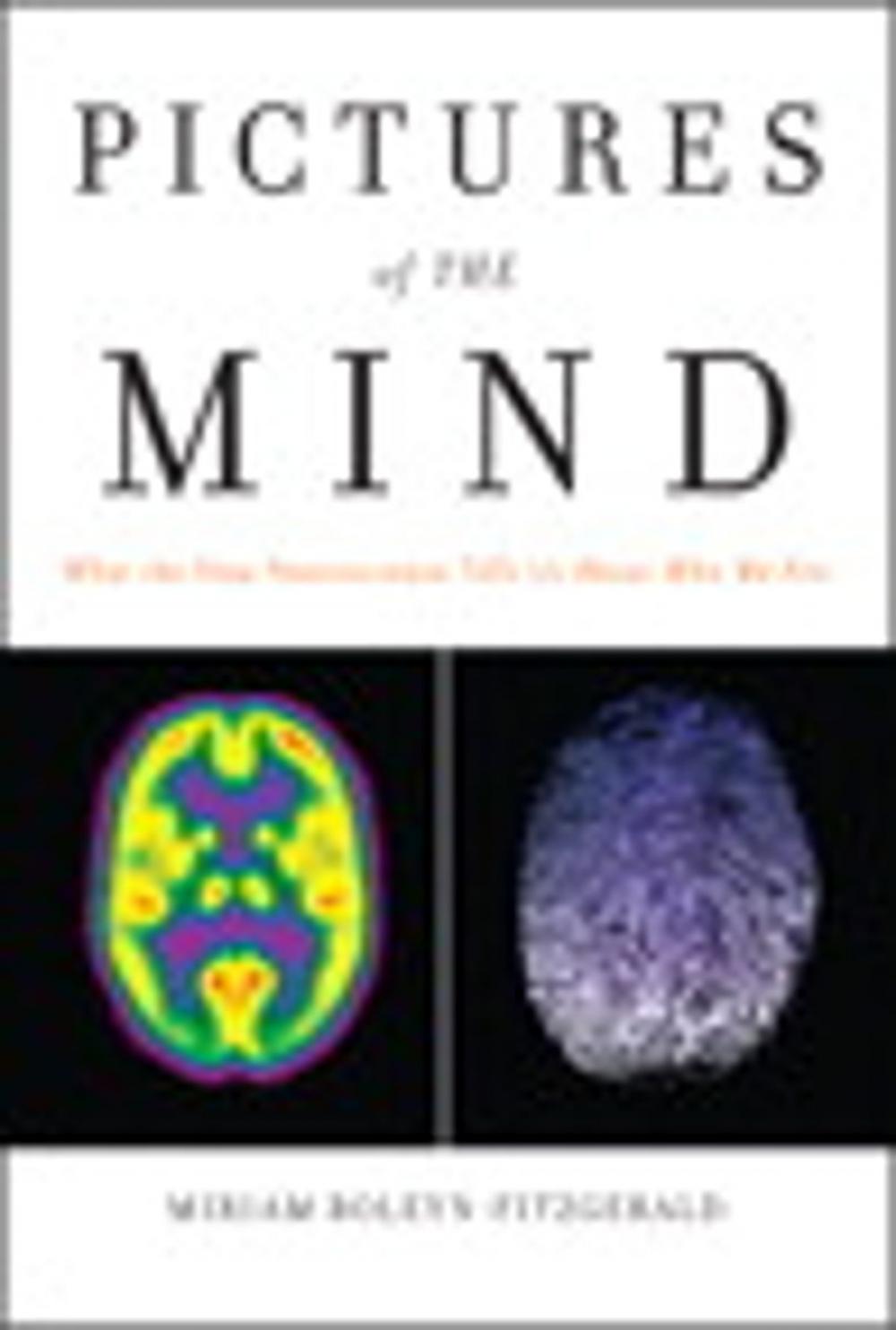 Big bigCover of Pictures of the Mind: What the New Neuroscience Tells Us About Who We Are