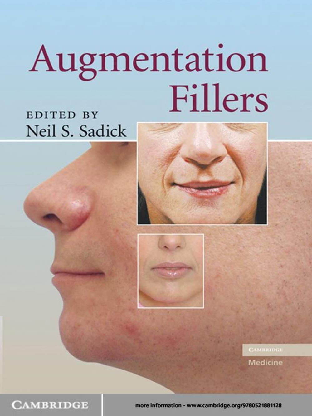 Big bigCover of Augmentation Fillers