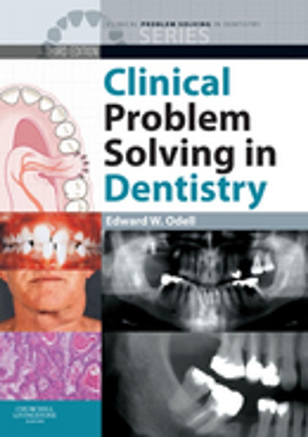 Big bigCover of Clinical Problem Solving in Dentistry E-Book