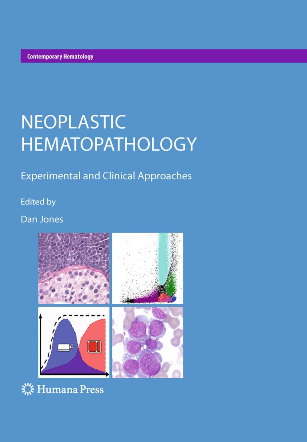 Big bigCover of Neoplastic Hematopathology