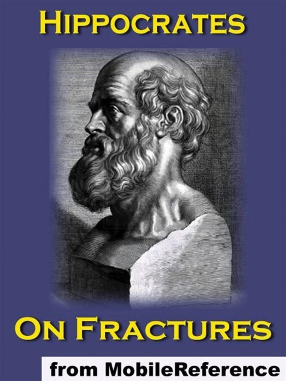 Big bigCover of On Fractures (Mobi Classics)