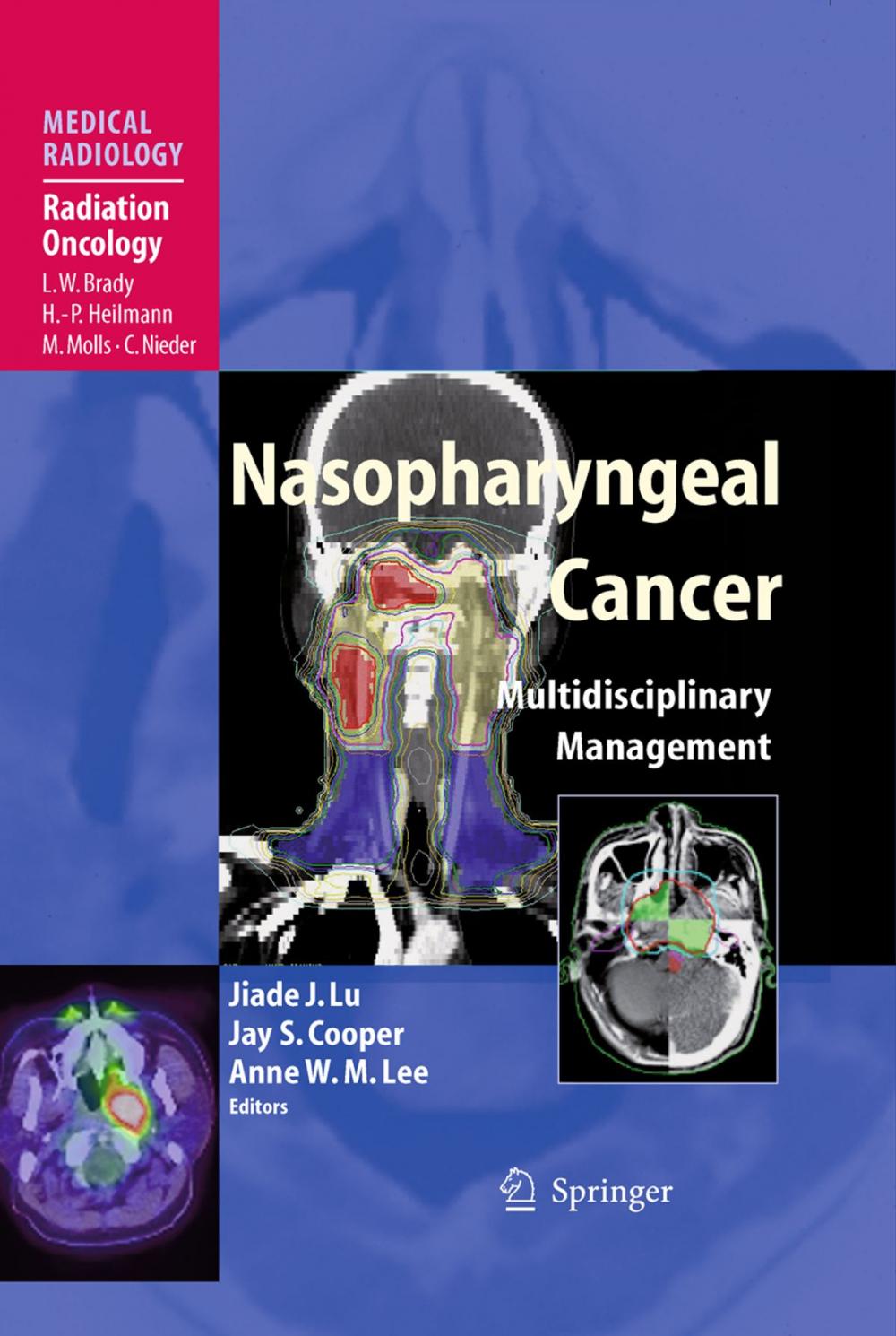 Big bigCover of Nasopharyngeal Cancer