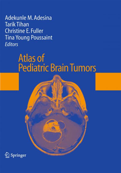 Cover of the book Atlas of Pediatric Brain Tumors by , Springer New York