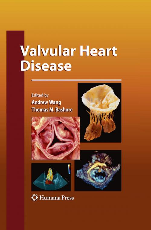 Cover of the book Valvular Heart Disease by , Humana Press