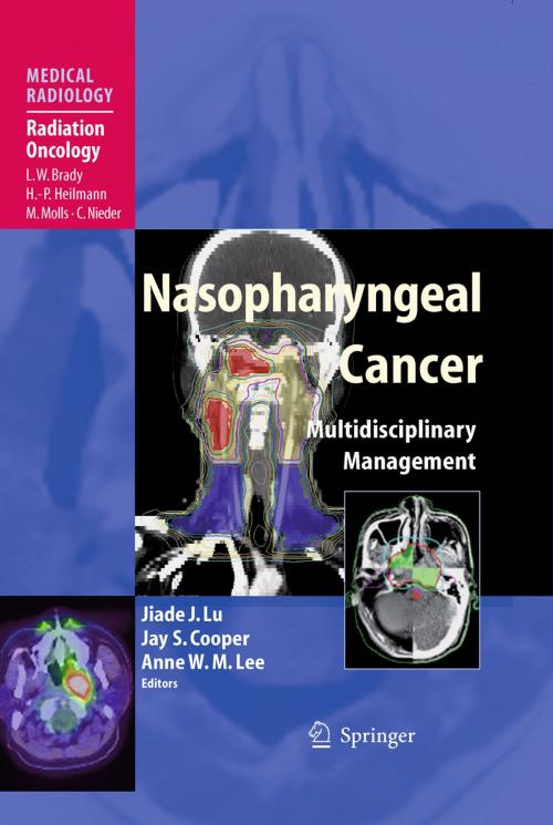 Cover of the book Nasopharyngeal Cancer by , Springer Berlin Heidelberg