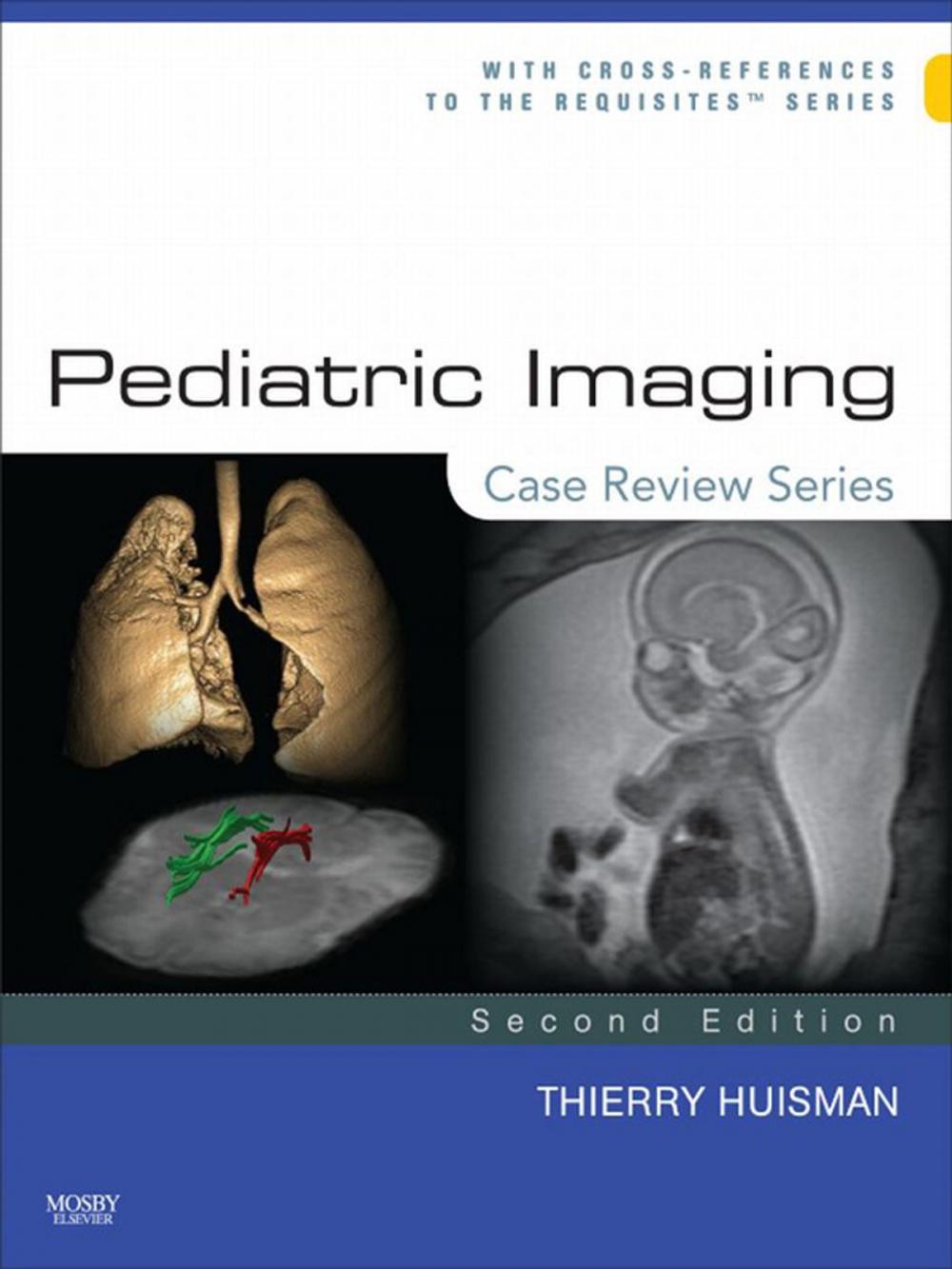 Big bigCover of Pediatric Imaging: Case Review Series E-Book