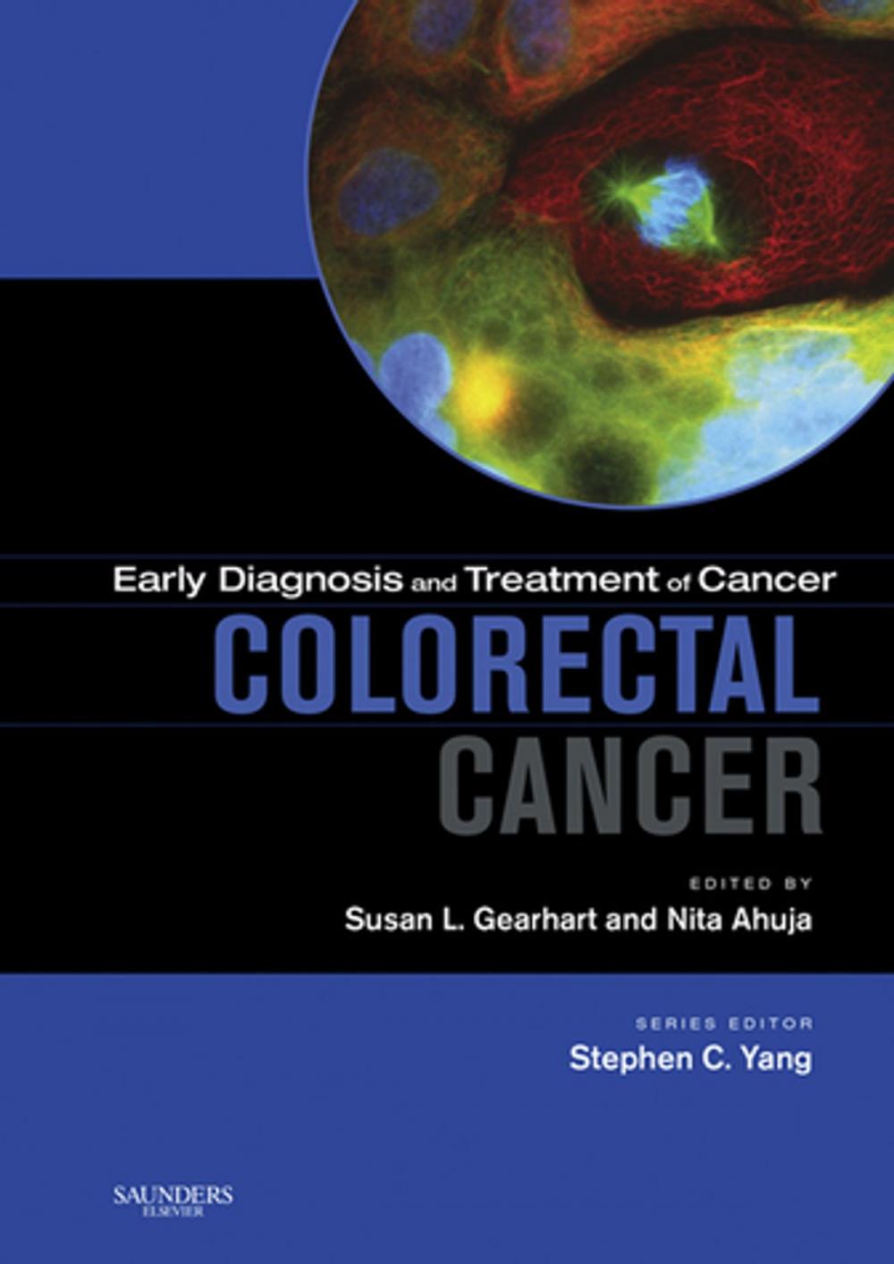 Big bigCover of Early Diagnosis and Treatment of Cancer Series: Colorectal Cancer E-Book