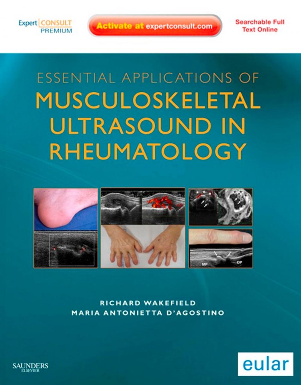 Big bigCover of Essential Applications of Musculoskeletal Ultrasound in Rheumatology E-Book