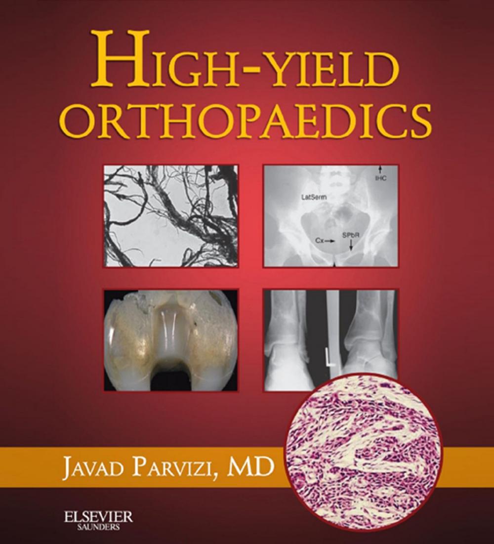 Big bigCover of High Yield Orthopaedics E-Book