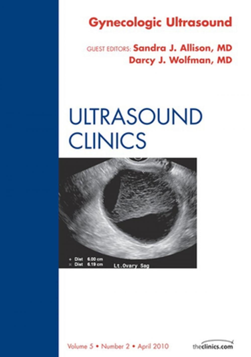 Big bigCover of Gynecologic Ultrasound, An Issue of Ultrasound Clinics - E-Book