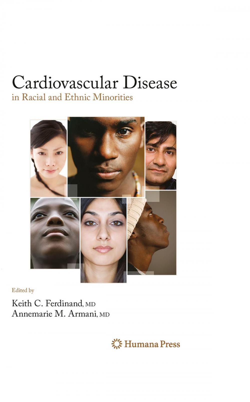 Big bigCover of Cardiovascular Disease in Racial and Ethnic Minorities