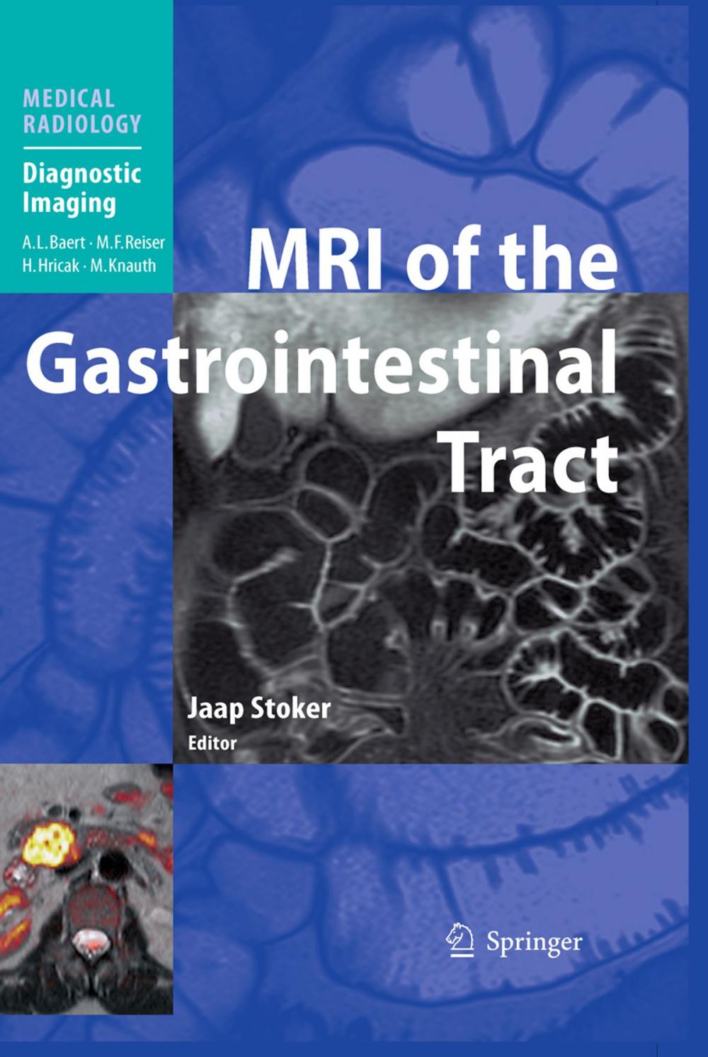 Big bigCover of MRI of the Gastrointestinal Tract