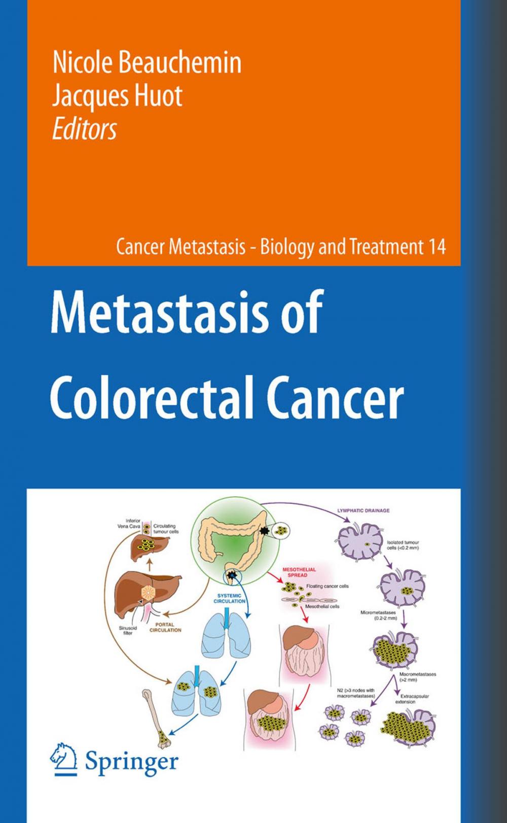 Big bigCover of Metastasis of Colorectal Cancer