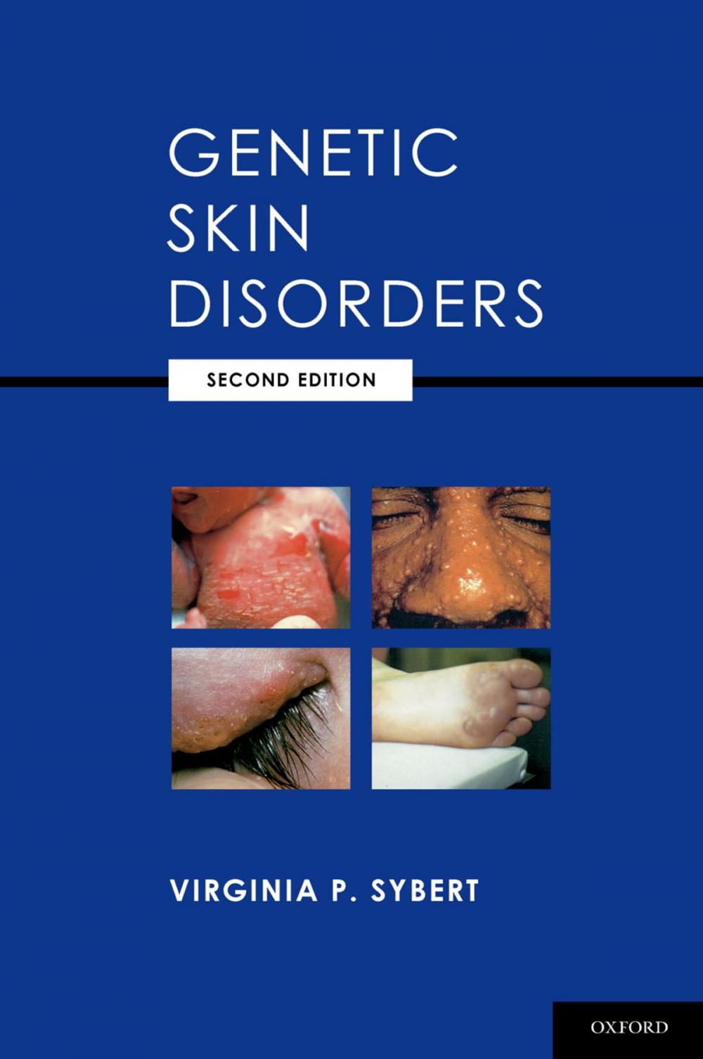 Big bigCover of Genetic Skin Disorders