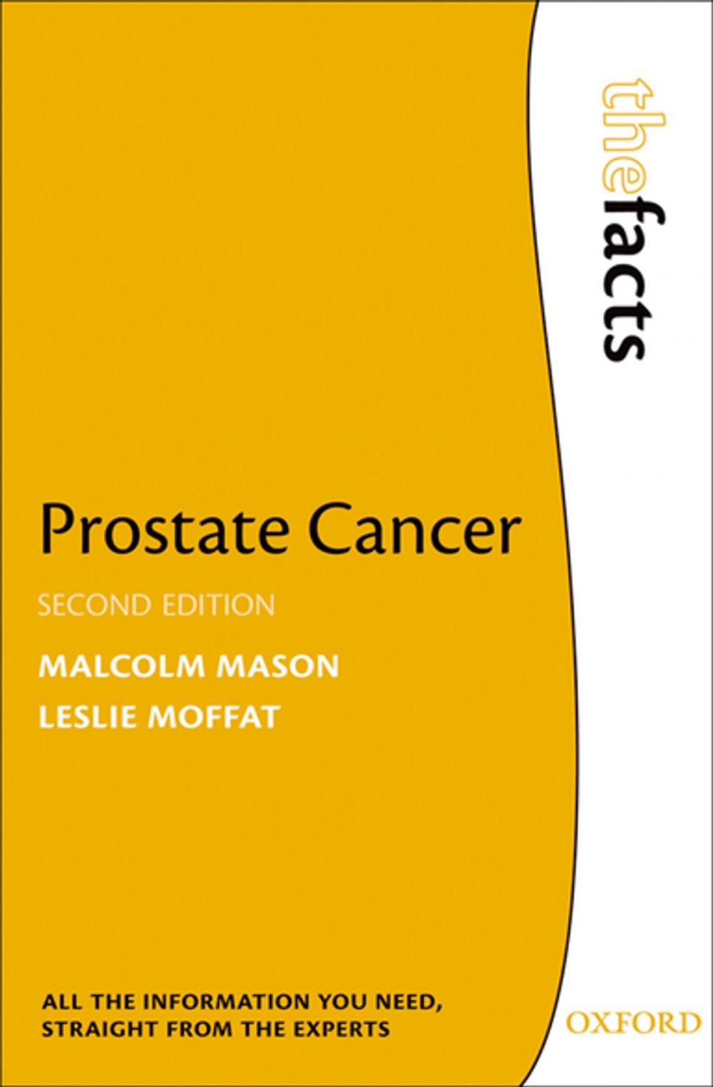 Big bigCover of Prostate Cancer