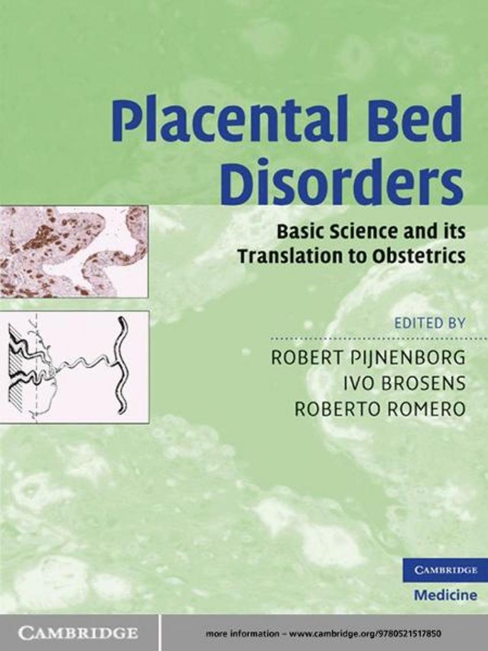 Big bigCover of Placental Bed Disorders