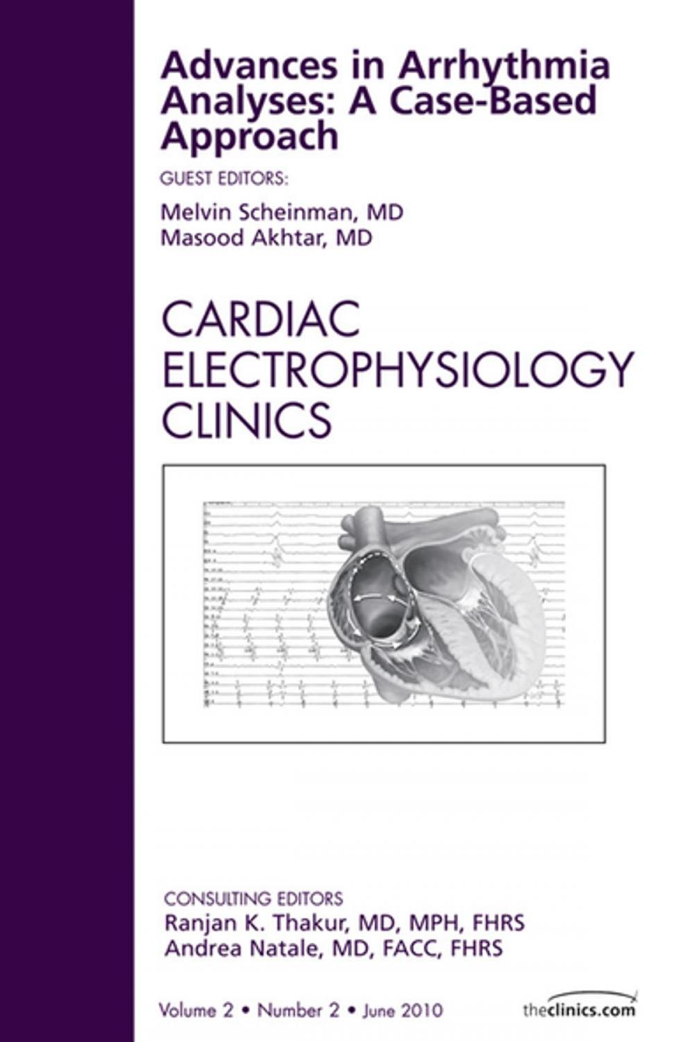 Big bigCover of Advances in Arrhythmia Analyses: A Case-Based Approach, An Issue of Cardiac Electrophysiology Clinics - E-Book