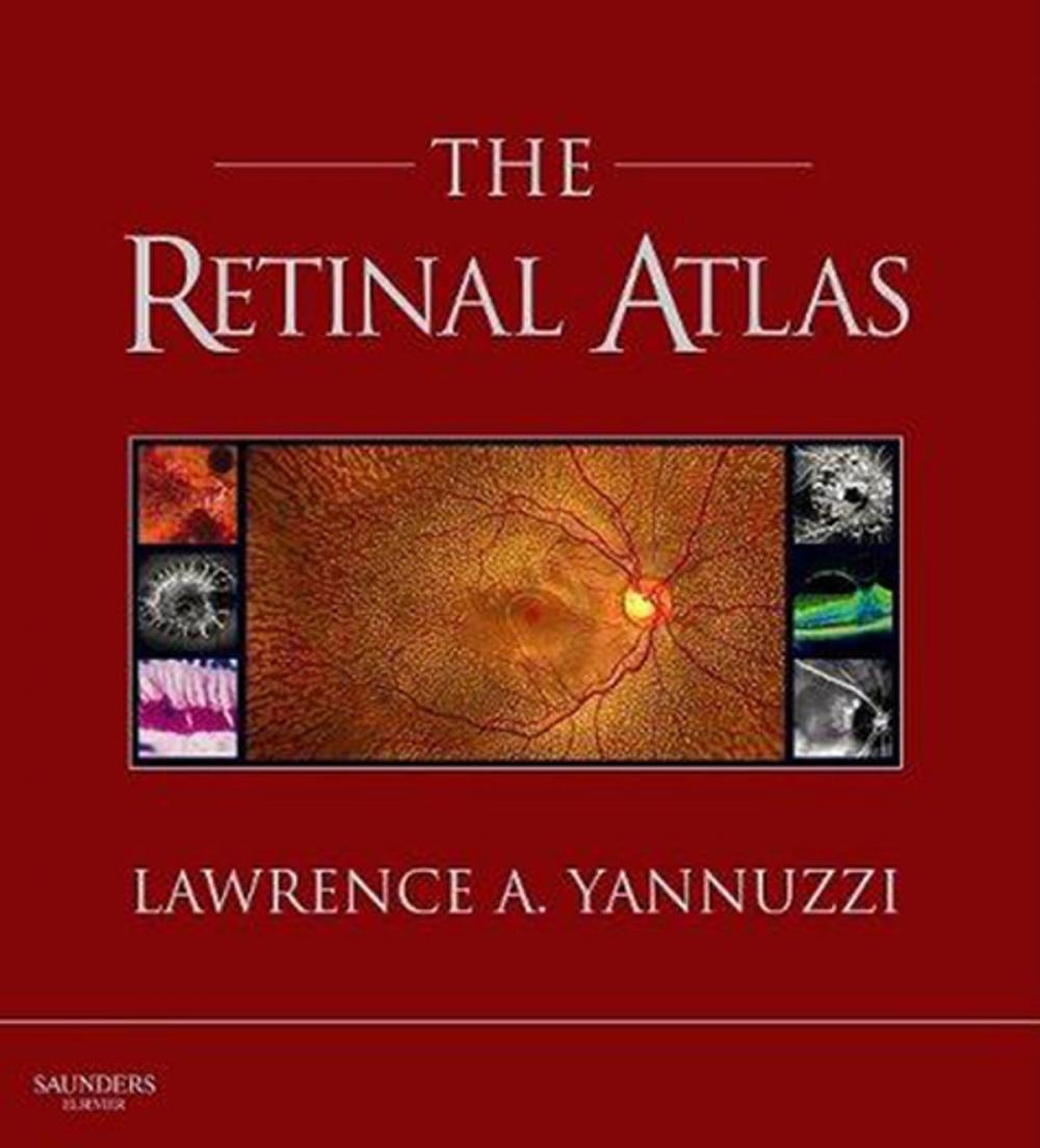 Big bigCover of The Retinal Atlas E-Book