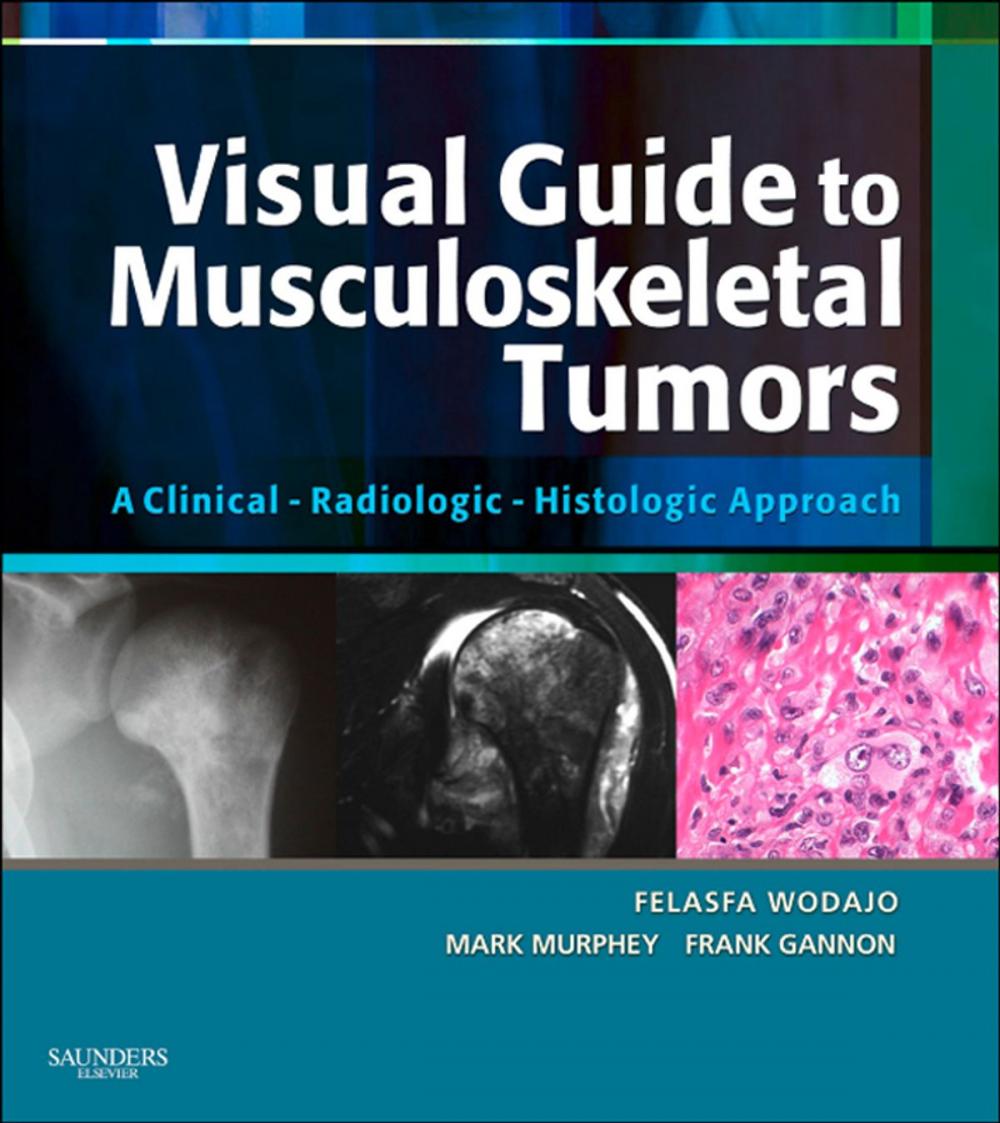 Big bigCover of Visual Guide to Musculoskeletal Tumors: A Clinical - Radiologic - Histologic Approach E-BOOK