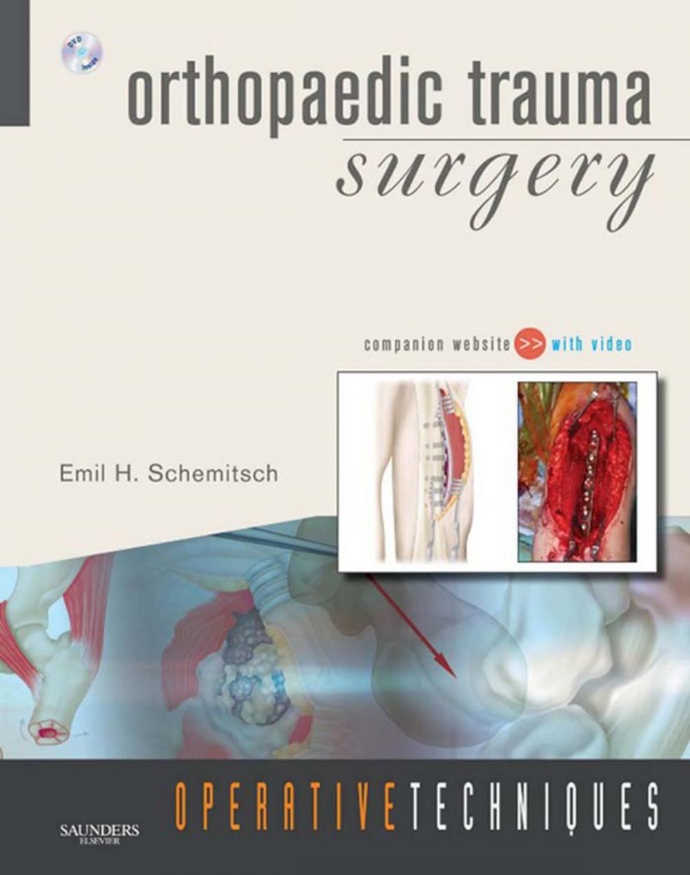 Big bigCover of Operative Techniques: Orthopaedic Trauma Surgery E-book