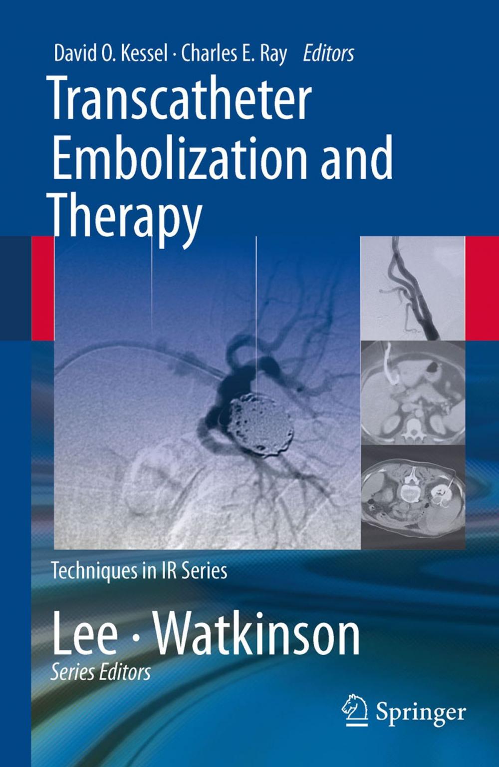 Big bigCover of Transcatheter Embolization and Therapy