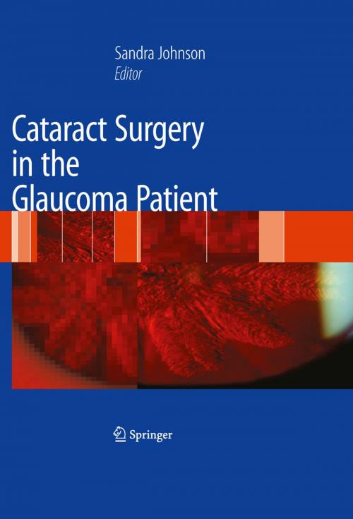 Cover of the book Cataract Surgery in the Glaucoma Patient by , Springer New York