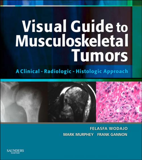 Cover of the book Visual Guide to Musculoskeletal Tumors: A Clinical - Radiologic - Histologic Approach E-BOOK by Frank Gannon, Felasfa M. Wodajo, MD, Mark D. Murphey, MD, Elsevier Health Sciences